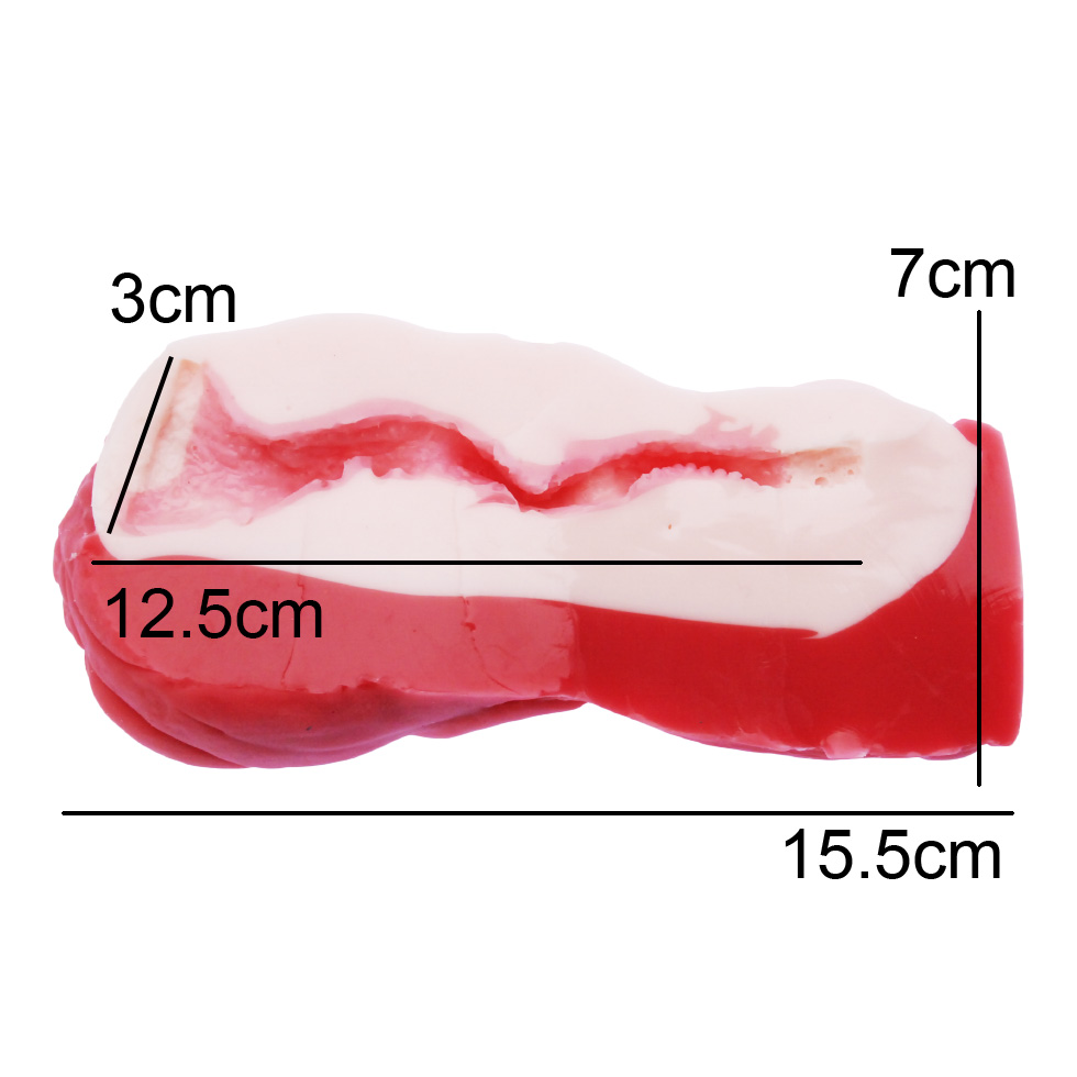 극채 몬스터 아루라우네
