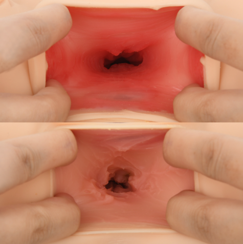리토푸리 - 어린공주