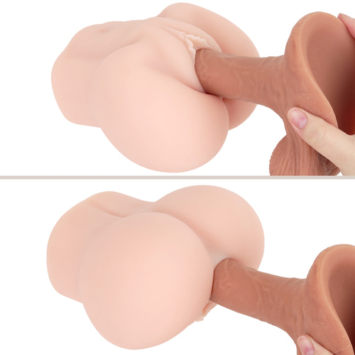 극상 질육 생음순